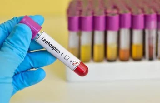На Черниговщине у женщины обнаружили лептоспироз: что известно