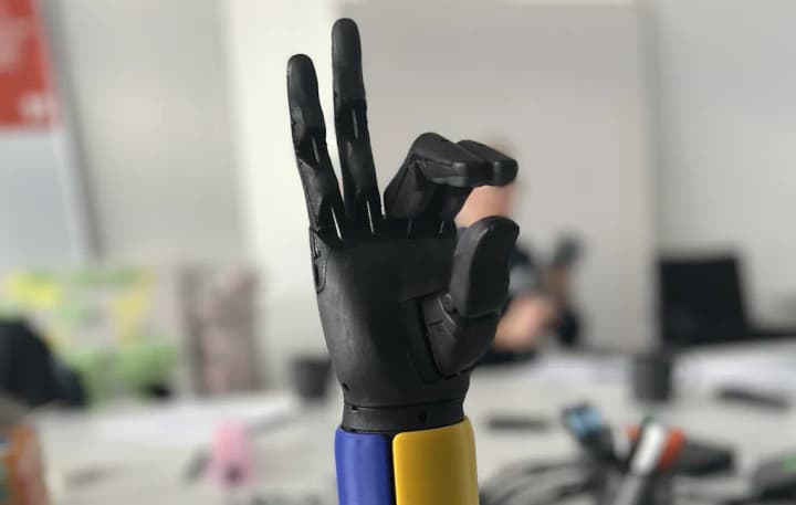 The Fund for Social Protection of Persons with Disabilities told how Ukrainians without limbs can get prostheses and how the state prosthetics program works