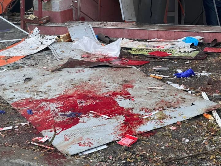 В Одесі після ворожої атаки зросла кількість постраждалих до 55 осіб