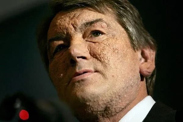 Russian special services behind Viktor Yushchenko's poisoning - Bloomberg