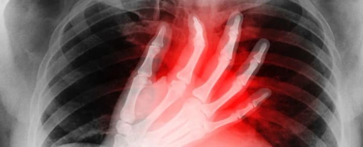 Holiday Heart Syndrome: what it is and why it is dangerous