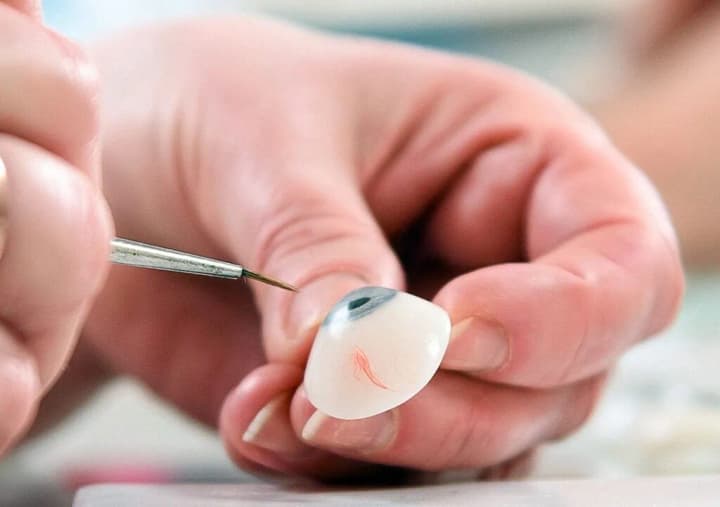 Who are eye doctors and why are they needed in Ukraine? A doctor tells