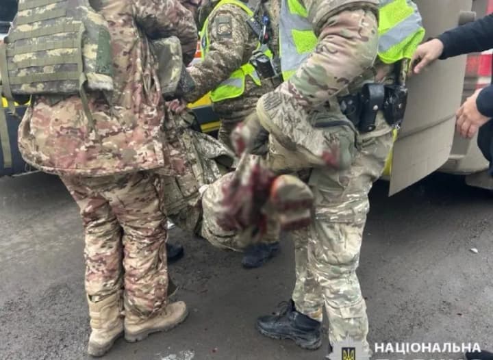 Russians attack police in Kharkiv region: three wounded