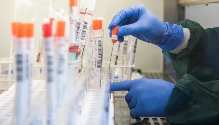 Разведку Германии призвали обнародовать данные расследования о происхождении COVID-19