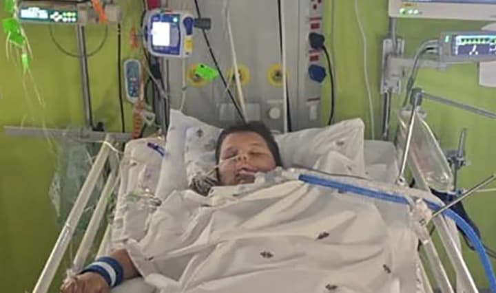 В ЮАР крокодил откусил руку 7-летнему мальчику во время рыбалки