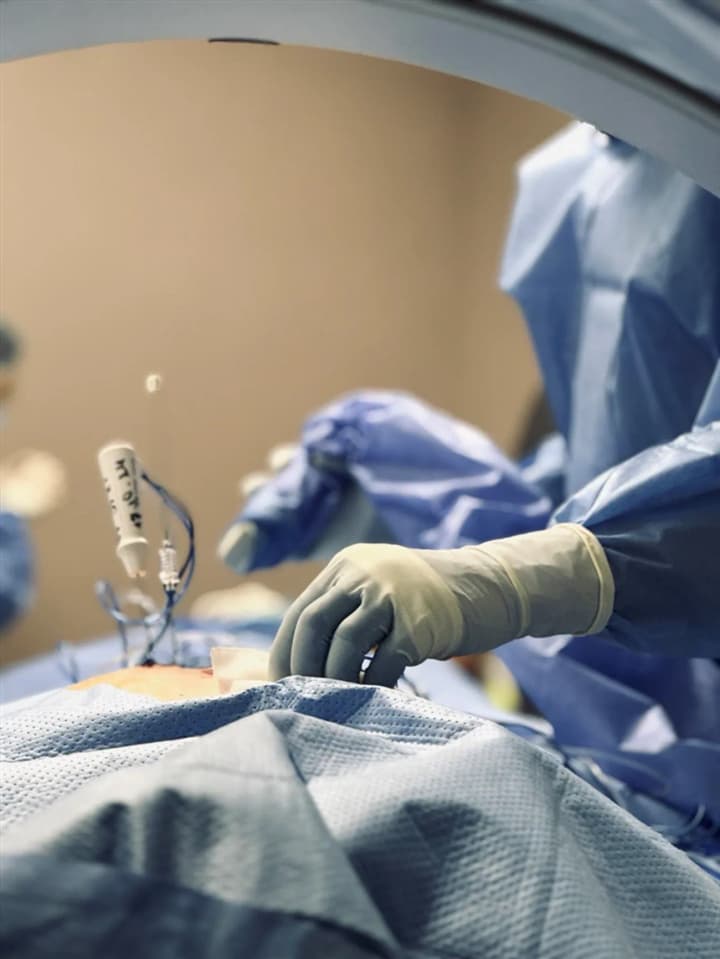 Radiofrequency ablation: Shalimov Center talks about an effective method of combating tumors