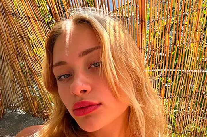 Украинская OnlyFans-модель Мария Ковальчук вышла из комы после операции