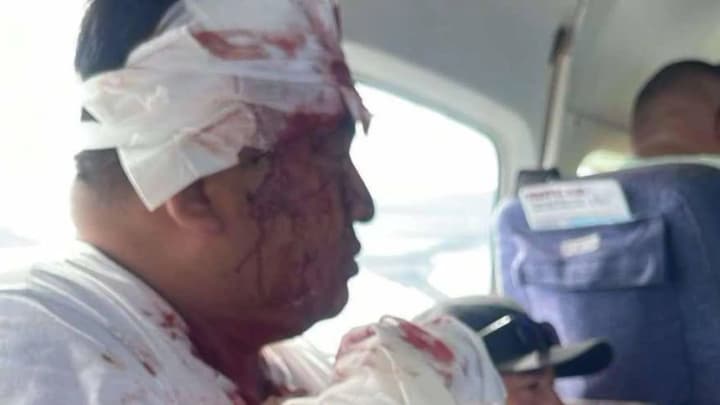 In Belize, a man hijacked a plane and stabbed three people on board: he was shot dead by one of the injured passengers