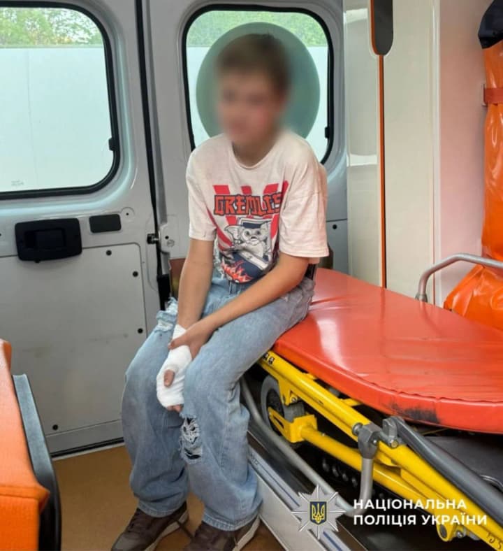 Приніс додому невідомі елементи живлення: під Києвом постраждав підліток