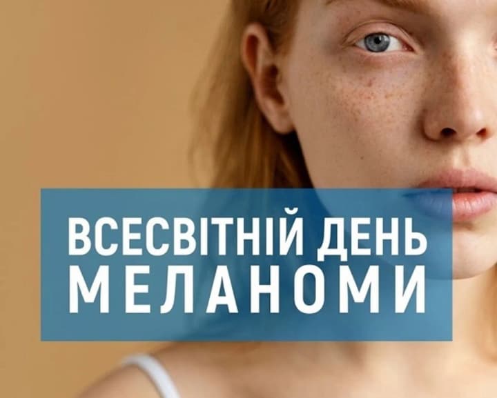 Всесвітній день меланоми: що треба знати про діагностику, лікування та реабілітацію