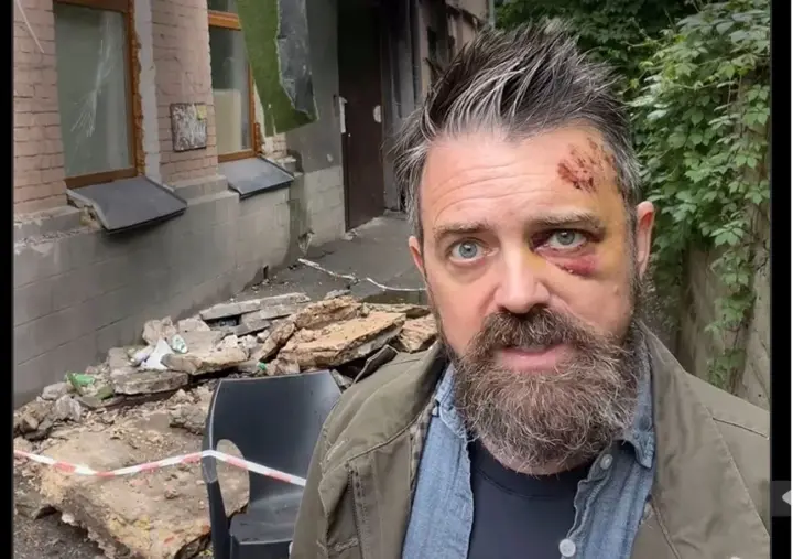 В Подольском районе на американца упал балкон перед входом в подъезд многоквартирного дома - КГВА
