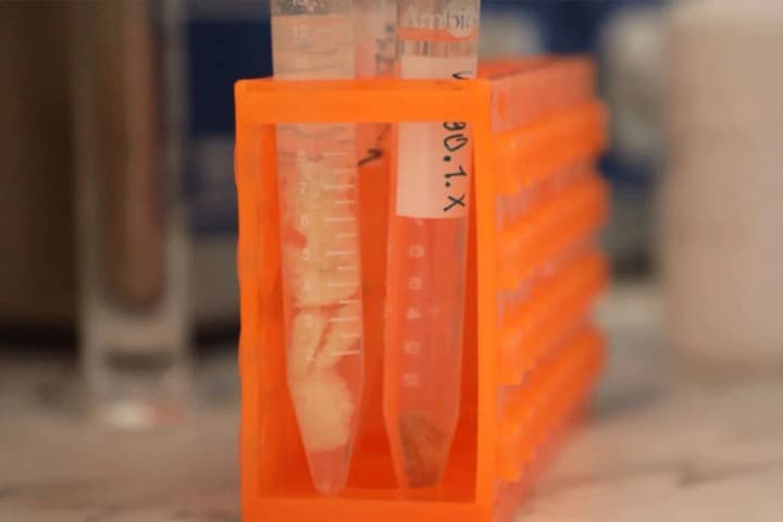 Collecting DNA from Ukrainians in the Baltic and Northern European countries to search for missing relatives: how long it will last and how to sign up