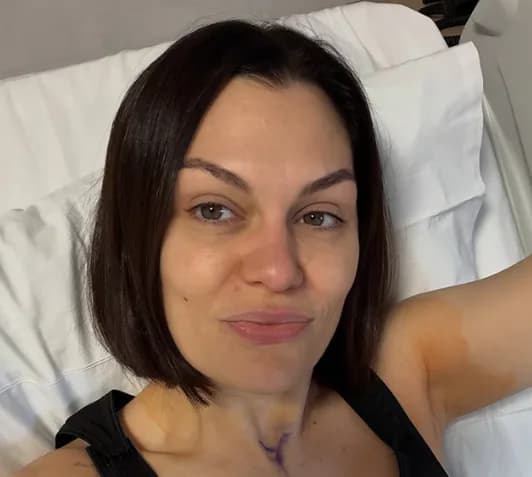 Jessie J showed how she is recovering after her second surgery for breast cancer