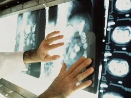 smertnist-vid-raku-do-2030-roku-zroste-na-45-vooz