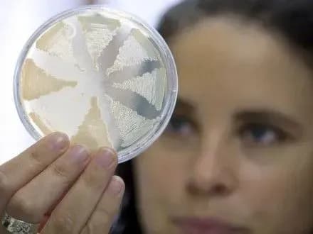 novi-vipadki-botulizmu-u-derzhprodspozhivsluzhbi-nazvali-ymovirni-dzherela-poshirennya-khvorobi