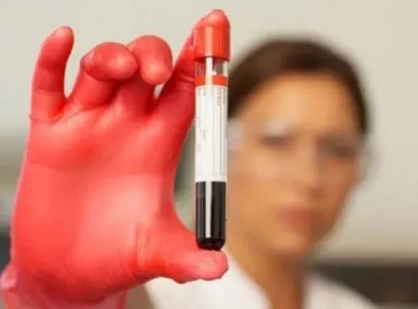 za-minuliy-tizhden-u-zaporizhzhi-sche-dvi-lyudini-zakhvorili-na-gepatit-a-ta-6-na-kir