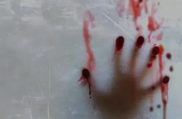 u-chernigivskiy-oblasti-v-lisosmuzi-znayshli-zhinochiy-cherep-ta-kistki