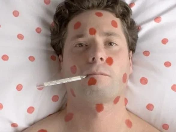 na-kirovogradschini-zareyestruvali-15-vipadkiv-koru