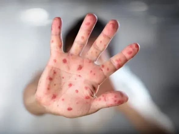 cherez-kir-v-uzhgorodi-zakrili-ditsadok