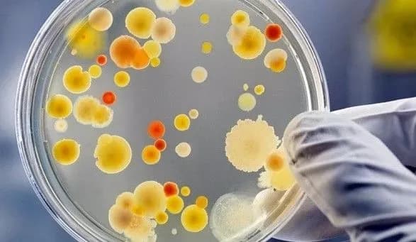 diagnoz-botulizm-pidtverdili-u-chotirokh-lyudey-na-kirovogradschini