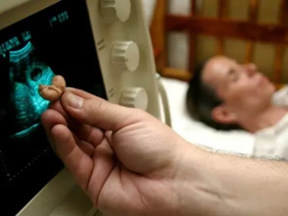 v-ukrayini-u-2018-rotsi-bulo-zrobleno-ponad-40-tisyach-abortiv