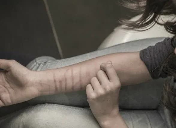 shkolyarka-porizala-ruku-lezom-cherez-internet-gru