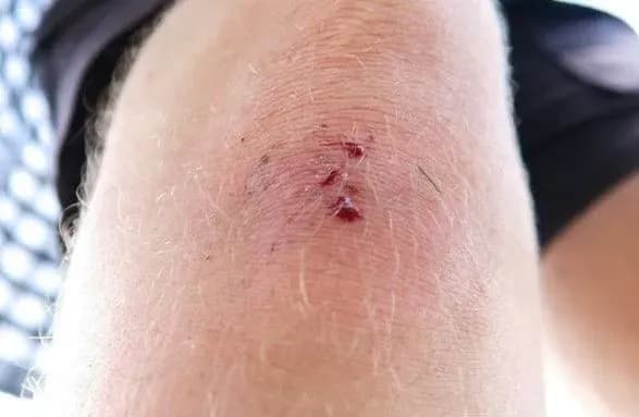 z-pochatku-roku-v-ukrayini-zareyestruvali-shist-vipadkiv-pravtsya