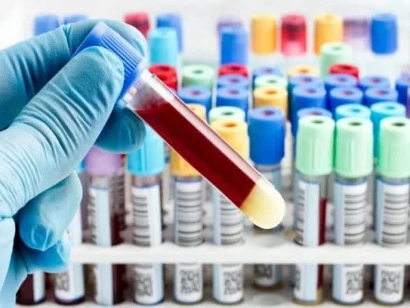 u-shkoli-na-odeschini-viyavili-spalakh-virusnogo-gepatitu-a