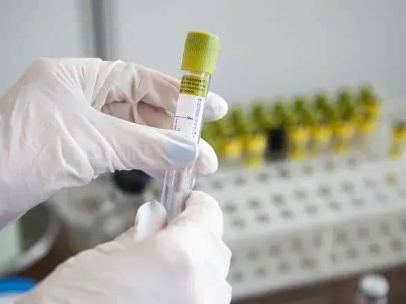 v-italiyi-zafiksovano-229-infikovanikh-koronavirusom-ukrayintsiv-sered-nikh-nemaye-posol