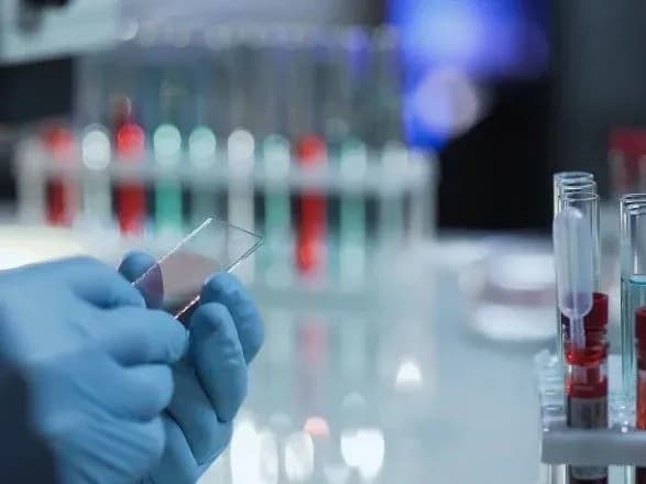 pyat-pidozr-na-koronavirus-ne-pidtverdilisya-sche-tri-pereviryayut-moz