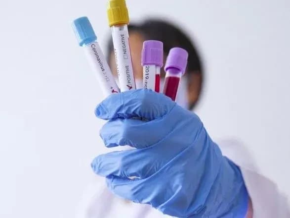 v-oblasti-vidpravlyayut-pershi-200-tis-plr-testiv-vitchiznyanogo-virobnitstva