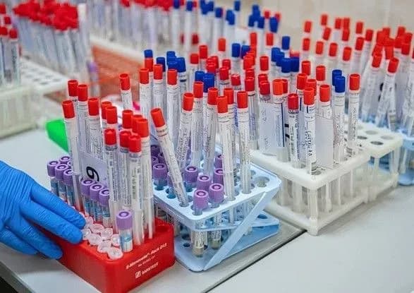 na-ukrayintsiv-chekaye-masove-ifa-testuvannya-na-koronavirus-lyashko