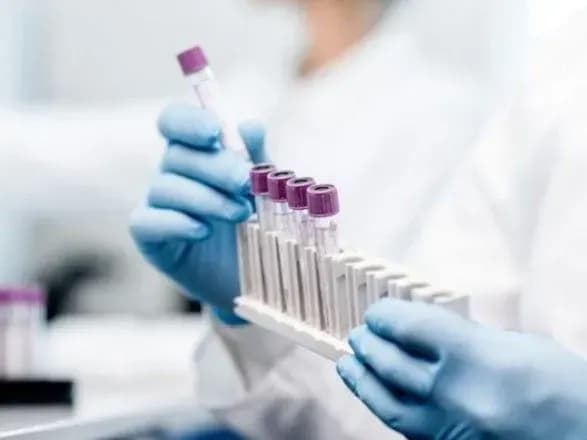 biznes-povinen-sistemno-testuvati-svoyikh-spivrobitnikiv-na-kovid-likar-rozpovila-yak-ta-navischo