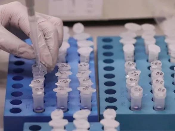 rozduti-tsini-na-plr-testi-eksperti-nazvali-realnu-vartist