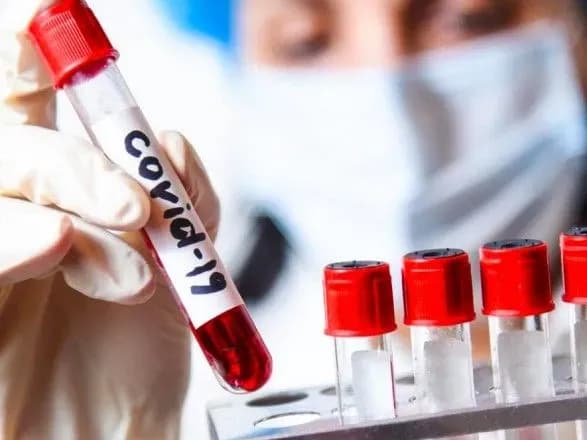 doslidzhennya-pokazali-scho-antitila-zakhischayut-vid-povtornogo-zarazhennya-covid-19-na-83