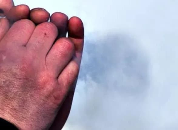 u-kiyevi-za-vikhidni-shestero-lyudey-potrapili-do-likaren-z-obmorozhennyam