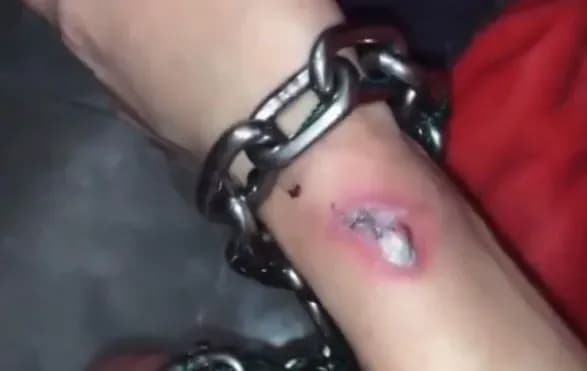 na-rutsi-zyavilisya-rani-u-skutoyi-lantsyugom-pari-zakokhanikh-z-kharkova-vinikli-problemi-zi-zdorovyam