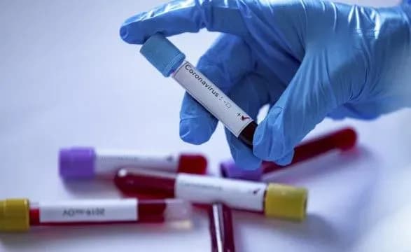 na-koronavirusnu-infektsiyu-u-sviti-zakhvorilo-vzhe-ponad-124-mln-osib