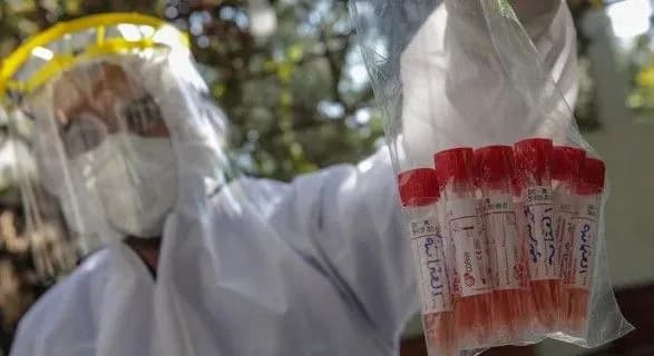 na-koronavirusnu-infektsiyu-u-sviti-zakhvorilo-vzhe-ponad-125-4-mln-osib