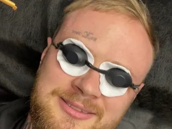 protrimavsya-mayzhe-piv-roku-kharkivyanin-ster-iz-loba-tatuyuvannya-kernes-zhiv