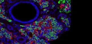 doslidzhennya-biologi-viyavili-ridkisnu-mutatsiyu-povyazanu-z-diabetom-drugogo-tipu