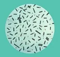 u-volinskiy-oblasti-gospitalizovano-zhinku-scho-infikuvalas-botulizmom