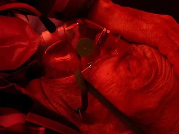 v-odesi-zyavilisya-shakhrayi-yaki-vimagayut-groshi-iz-khvorikh-za-kisen