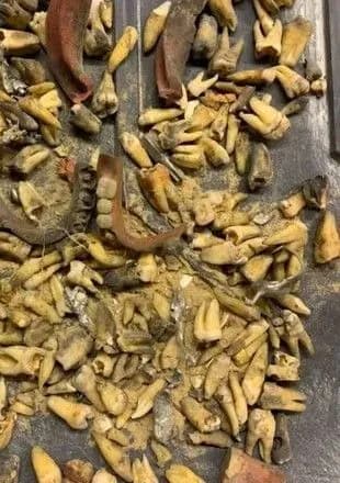 u-ssha-na-robitnika-pid-chas-remontu-zi-steli-vpali-sotni-gnilikh-zubiv