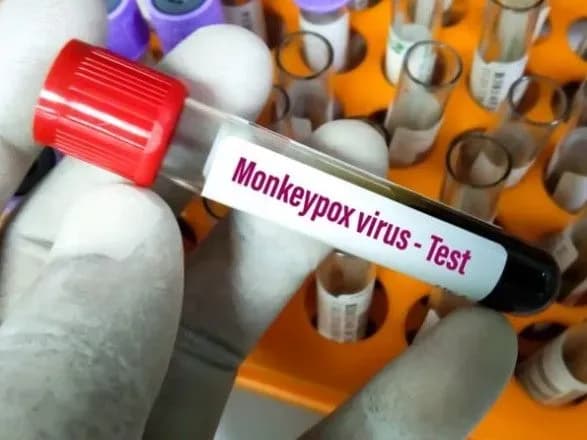 v-ispaniyi-povidomili-pro-drugu-smert-vid-mavpyachoyi-vispi