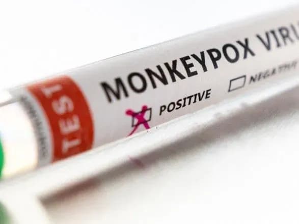 meksika-ta-kuba-povidomili-pro-smert-dvokh-osib-u-yakikh-buv-pozitivniy-rezultat-testu-na-mavpyachu-vispu