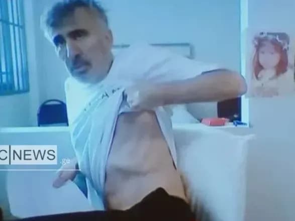 saakashvili-bilshist-moyikh-simptomiv-vid-otruyennya-vazhkimi-metalami