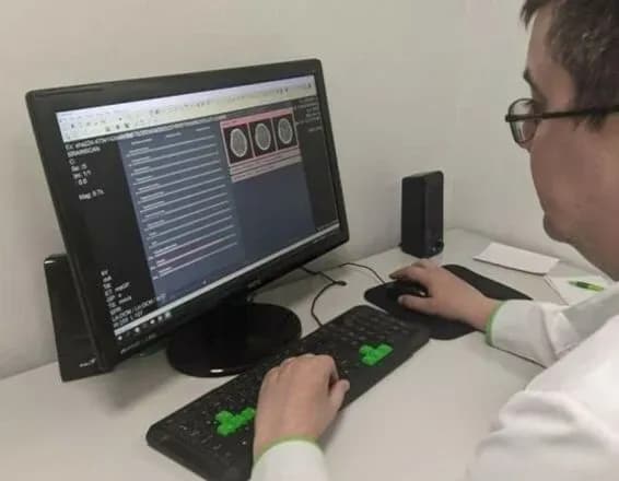 odesa-vprovadila-shtuchniy-intelekt-dlya-diagnostiki-zakhvoryuvan-golovnogo-mozku