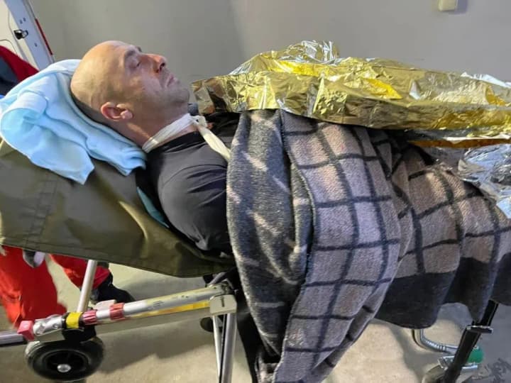 on-their-way-to-a-call-and-under-attack-from-russia-two-policemen-were-injured-in-kherson-region