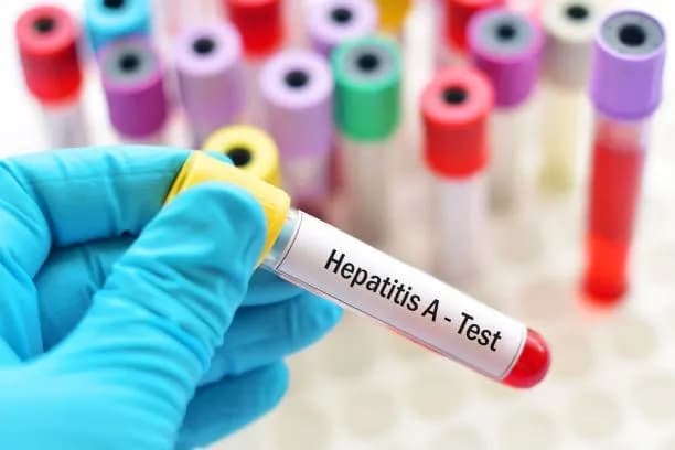 hepatitis-a-outbreak-in-vinnytsia-region-the-likely-source-of-infection-was-found-at-the-local-market-kuzin
